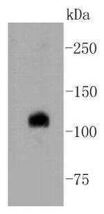 NOTCH1 Antibody in Western Blot (WB)