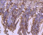 APAF1 Antibody in Immunohistochemistry (Paraffin) (IHC (P))