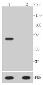 Phospho-PKR (Thr446) Antibody in Western Blot (WB)