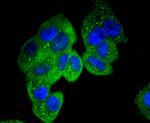 Paxillin Antibody in Immunocytochemistry (ICC/IF)