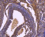 Paxillin Antibody in Immunohistochemistry (Paraffin) (IHC (P))