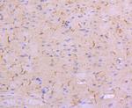 N-cadherin Antibody in Immunohistochemistry (Paraffin) (IHC (P))