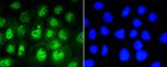 Phospho-STAT3 (Ser727) Antibody in Immunocytochemistry (ICC/IF)