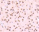 Phospho-STAT3 (Ser727) Antibody in Immunohistochemistry (Paraffin) (IHC (P))