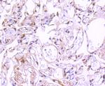 Phospho-STAT3 (Ser727) Antibody in Immunohistochemistry (Paraffin) (IHC (P))