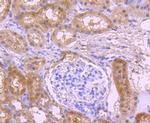 NOX4 Antibody in Immunohistochemistry (Paraffin) (IHC (P))