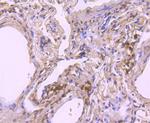 NOX4 Antibody in Immunohistochemistry (Paraffin) (IHC (P))