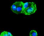 SMAD3 Antibody in Immunocytochemistry (ICC/IF)