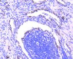 SMAD3 Antibody in Immunohistochemistry (Paraffin) (IHC (P))