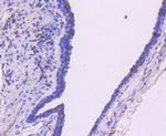 SMAD3 Antibody in Immunohistochemistry (Paraffin) (IHC (P))