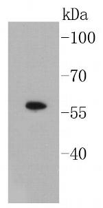 SMAD3 Antibody in Western Blot (WB)