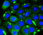 CDK1 Antibody in Immunocytochemistry (ICC/IF)