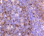 TOP2A Antibody in Immunohistochemistry (Paraffin) (IHC (P))