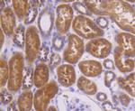 TOP2A Antibody in Immunohistochemistry (Paraffin) (IHC (P))