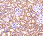 TOP2A Antibody in Immunohistochemistry (Paraffin) (IHC (P))