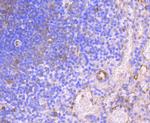 HAPLN1 Antibody in Immunohistochemistry (Paraffin) (IHC (P))