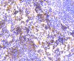 HAPLN1 Antibody in Immunohistochemistry (Paraffin) (IHC (P))