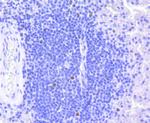 Rb Antibody in Immunohistochemistry (Paraffin) (IHC (P))