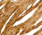 PKC alpha Antibody in Immunohistochemistry (Paraffin) (IHC (P))