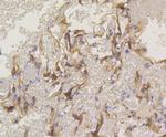 PKC alpha Antibody in Immunohistochemistry (Paraffin) (IHC (P))