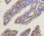 PKC alpha Antibody in Immunohistochemistry (Paraffin) (IHC (P))