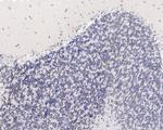 ELK1 Antibody in Immunohistochemistry (Paraffin) (IHC (P))