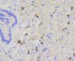 ABCG1 Antibody in Immunohistochemistry (Paraffin) (IHC (P))