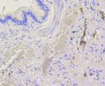 BAK Antibody in Immunohistochemistry (Paraffin) (IHC (P))