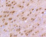 DARPP-32 Antibody in Immunohistochemistry (Paraffin) (IHC (P))