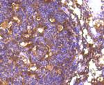 FOXO1 Antibody in Immunohistochemistry (Paraffin) (IHC (P))