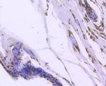 FOXO1 Antibody in Immunohistochemistry (Paraffin) (IHC (P))