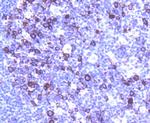 Cyclin B1 Antibody in Immunohistochemistry (Paraffin) (IHC (P))