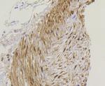 YAP1 Antibody in Immunohistochemistry (Paraffin) (IHC (P))