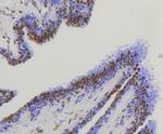 YAP1 Antibody in Immunohistochemistry (Paraffin) (IHC (P))