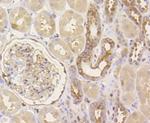 YAP1 Antibody in Immunohistochemistry (Paraffin) (IHC (P))