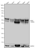 Cytokeratin 8 Antibody in Western Blot (WB)