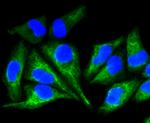 Cytokeratin 8 Antibody in Immunocytochemistry (ICC/IF)