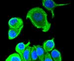 Cytokeratin 8 Antibody in Immunocytochemistry (ICC/IF)