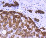 Cytokeratin 8 Antibody in Immunohistochemistry (Paraffin) (IHC (P))