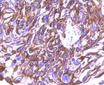 Cytokeratin 8 Antibody in Immunohistochemistry (Paraffin) (IHC (P))