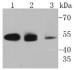 Cytokeratin 8 Antibody in Western Blot (WB)