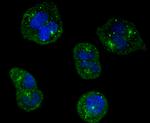 TrkA Antibody in Immunocytochemistry (ICC/IF)