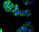 CaMKII Pan Antibody in Immunocytochemistry (ICC/IF)