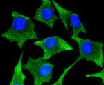 CaMKII Pan Antibody in Immunocytochemistry (ICC/IF)