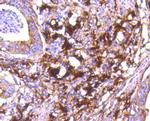 Cathepsin D Antibody in Immunohistochemistry (Paraffin) (IHC (P))