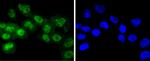 Phospho-RSK1 (Thr359, Ser363) Antibody in Immunocytochemistry (ICC/IF)