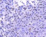 Phospho-RSK1 (Thr359, Ser363) Antibody in Immunohistochemistry (Paraffin) (IHC (P))