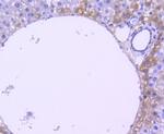 Phospho-RSK1 (Thr359, Ser363) Antibody in Immunohistochemistry (Paraffin) (IHC (P))