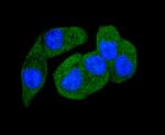 Phospho-PAK1/2/3 (Ser144, Ser141, Ser139) Antibody in Immunocytochemistry (ICC/IF)