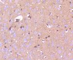 Phospho-PAK1/2/3 (Ser144, Ser141, Ser139) Antibody in Immunohistochemistry (Paraffin) (IHC (P))